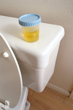 urine_test.jpg